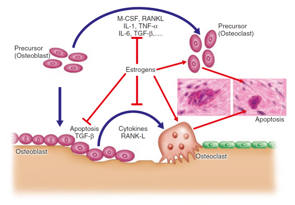 Pathophysiology International Osteoporosis Foundation 7088