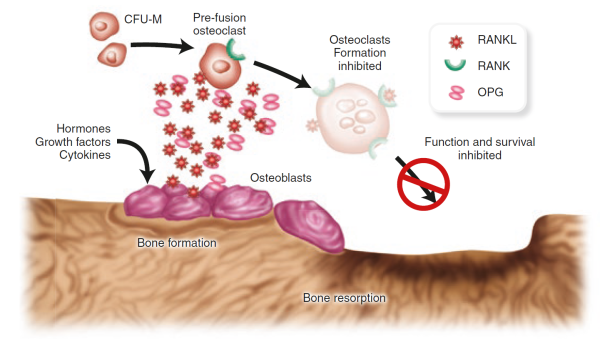 Osteoprotegerin (OPG) inhibits osteoclastogenesis