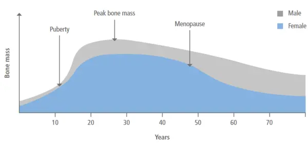 Prevent Osteoporosis: Diet, Exercise Lifestyle Tips