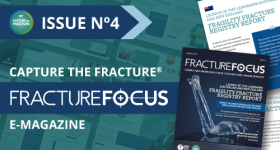 fracture focus issue of August 2024